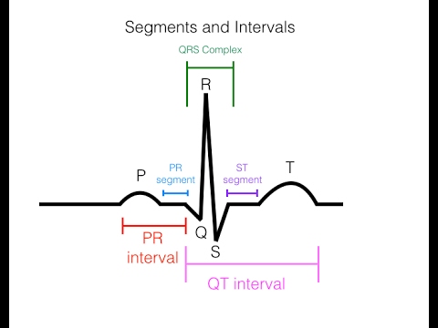 Reading an ekg